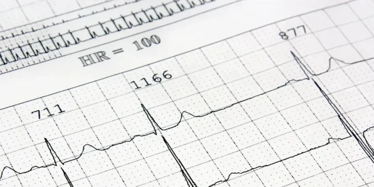 Curso CFC Electrocardiografía Básica