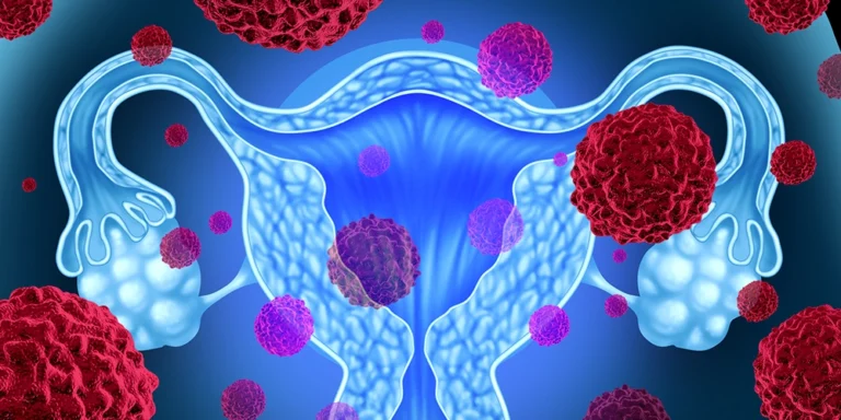 Curso CFC Infecciones del Tracto Genital Femenino