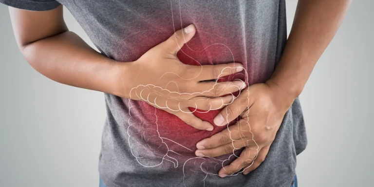 Curso CFC Enfermedades del Tracto Gastrointestinal Inferior