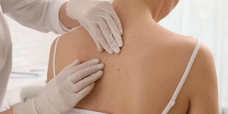 Curso CFC Urgencias Dermatologicas